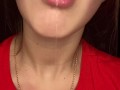 Messy drooling