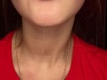 Messy drooling
