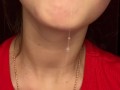 Messy drooling
