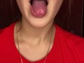 Messy drooling