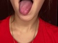 Messy drooling