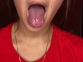 Messy drooling