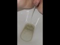 Week 48 Pee diary