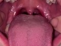 Uvula show. Very close view. Gagging