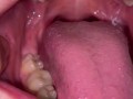 Uvula show. Very close view. Gagging