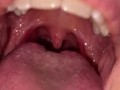 Uvula show. Very close view. Gagging