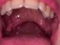 Open mouth gummy swallowing. Underwear