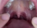 Uvula show. Mouth tour