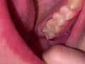 Mouth tour. Uvula and teeth