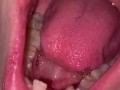 Mouth tour. Uvula and teeth