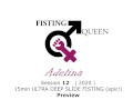 EPIC Anal Fisting Adelina & Fistude DEEP PUNCH FISTING Session 12 Preview