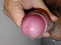 Closeup of uncircumcised micropenis precum play, very juicy, please enjoy!