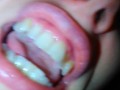 ANGRY EMO Sad Girl Freestyle Poetry Singing PinkMoonLust 's Camera fails & Lags After End - She Eats