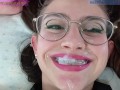 CUM ON MY BRACES COSPLAY NERDY BLOWJOB FUCK TEEN. SHANAXNOW