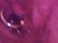 Close up otoscope endoscope pee peeing urine piss pissing