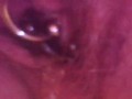 Close up otoscope endoscope pee peeing urine piss pissing