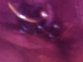 Close up otoscope endoscope pee peeing urine piss pissing