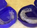 FAN REQUEST(Dental Device): Cumshot into mouth guards inserted into my mouth so I could enjoy my cum