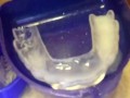 FAN REQUEST(Dental Device): Cumshot into mouth guards inserted into my mouth so I could enjoy my cum