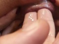 First prolapse of my ass Anal fisting that makes me squirt Anal fingering Red rose of my asshole