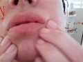 Lips and face massage Fitness for the face My sensual lips are perfect