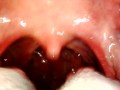 My throat with endoscope