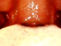 My throat with endoscope