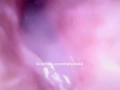 Internal creampie pussy camera using cum as lube