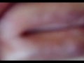 Urethral opening