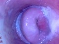 Pussy cum, Pussy cam!! (Endoscope inside creampied pussy)