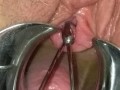 BDSM Pussy Torture Urethral Stretching Medical Fetish Speculum Peehole Play