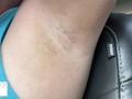 armpit hair even after laser removal - glimpseofme