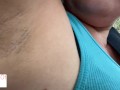 armpit hair even after laser removal - glimpseofme