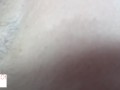 armpit hair even after laser removal - glimpseofme