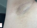 armpit hair even after laser removal - glimpseofme