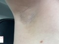 armpit hair even after laser removal - glimpseofme