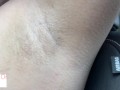 armpit hair even after laser removal - glimpseofme