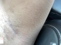 armpit hair even after laser removal - glimpseofme