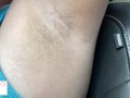 armpit hair even after laser removal - glimpseofme