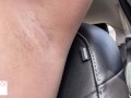 armpit hair even after laser removal - glimpseofme