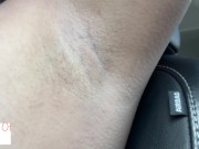 armpit hair even after laser removal - glimpseofme