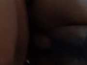 Vagina abierta