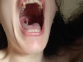 PIMPLE POPPING! Spontaneously Orgasming Crazy Camgirl PinkMoonLust Pops Pimples Face & Talks Orgasm