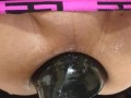 アナル拡張　大きすぎて入らない