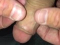 Twisting the shaft of my cock beyond 360 degrees and letting it go, observe in slow motion too