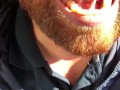 SFW Behind the Scenes look at my newly untied tongue immediately before & after surgery today  
