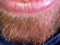 SFW Behind the Scenes look at my newly untied tongue immediately before & after surgery today  