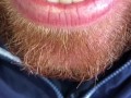 SFW Behind the Scenes look at my newly untied tongue immediately before & after surgery today  