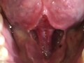 SFW Behind the Scenes look at my newly untied tongue immediately before & after surgery today  