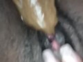 Say "Ahhh"